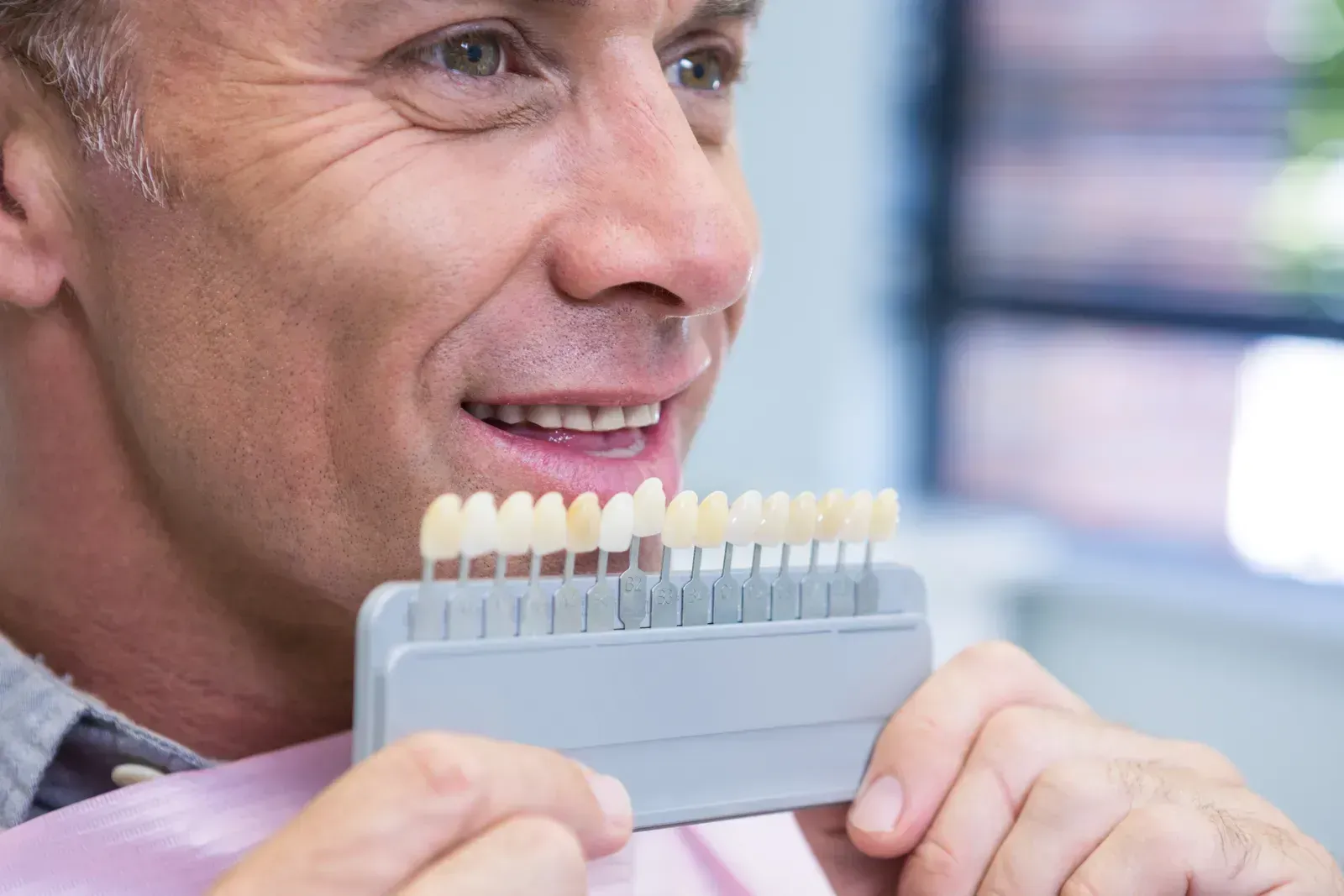 Porcelain Veneers: Cost, Process, and What to Expect